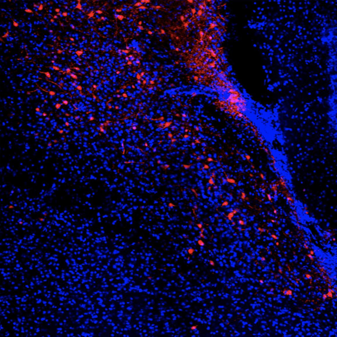 Addgene: AAV Data Hub - pAAV-hSyn-DIO-mCherry in Mouse (AAV2)